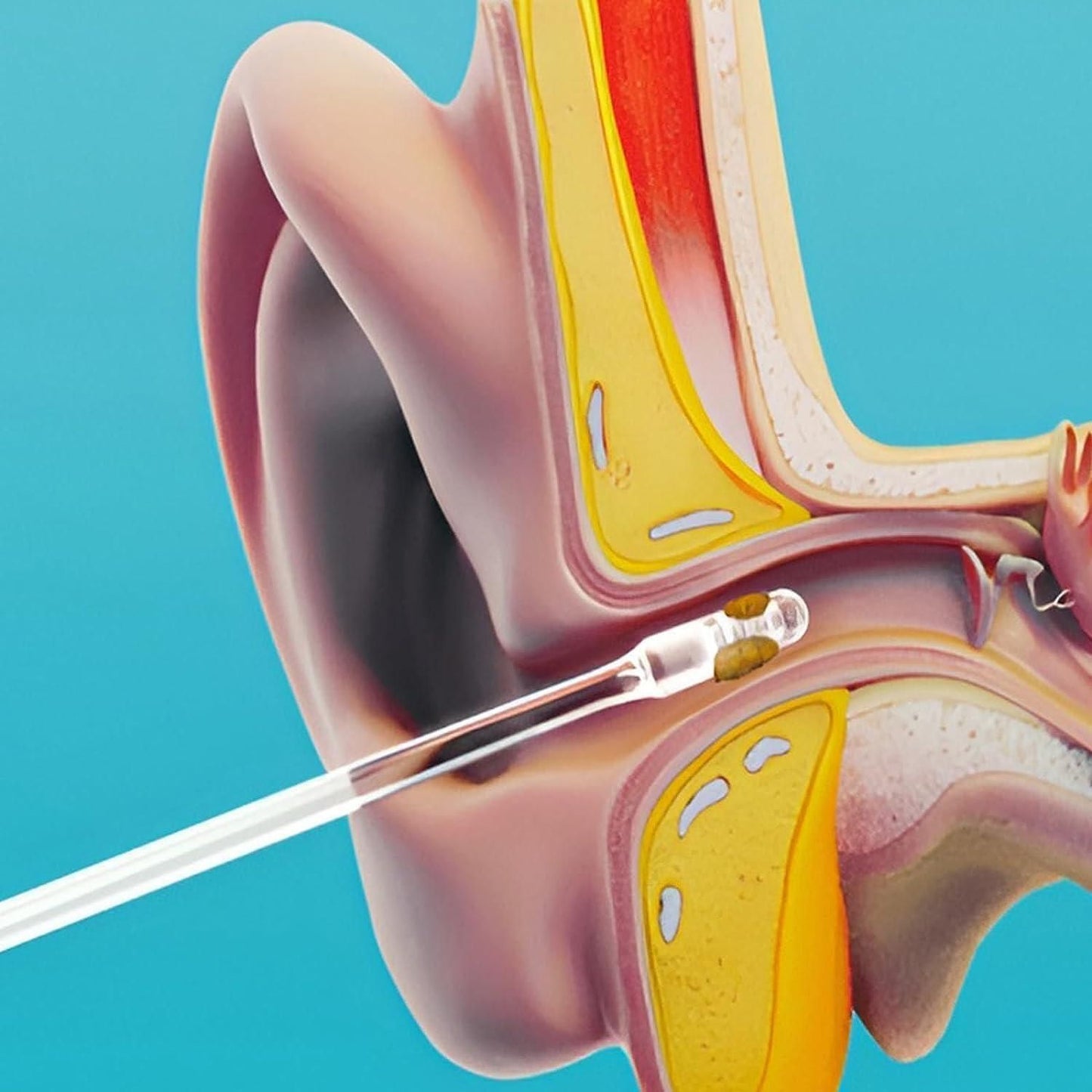 24 Pcs Ear Wax Cleaner Sticks